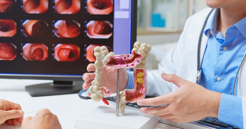 Doctor explain colonoscopy exam stock photo