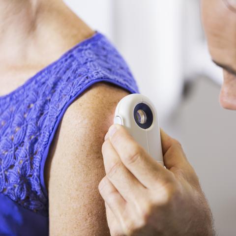 skin cancer screening