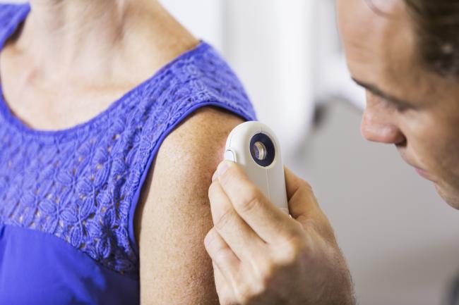 skin cancer screening